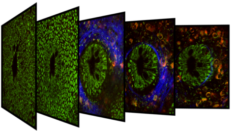 Label-free multiphoton microscopy in a fresh tissue biopsy of healthy human colon (Image: MBT/FAU)